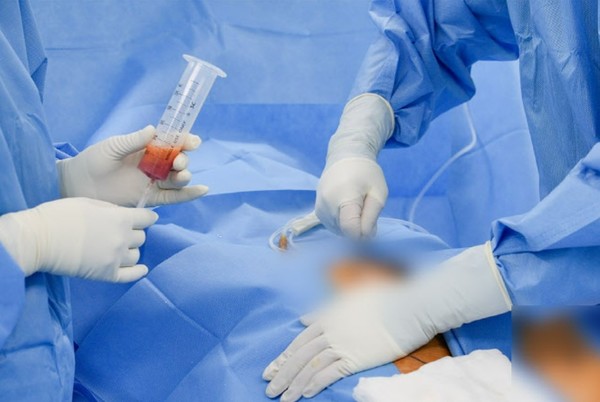 연세사랑병원 의료진이 환자의 수면마취 하에 환자 자신의 몸에 있는 지방조직을 채취하고 있다. /사진=연세사랑병원