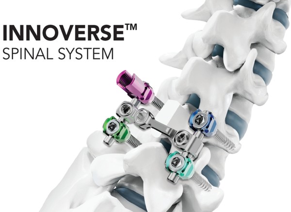 척추 고정 장치 '이노버스 스파이널 시스템(INNOVERSE Spinal System)' /사진=시지메드텍